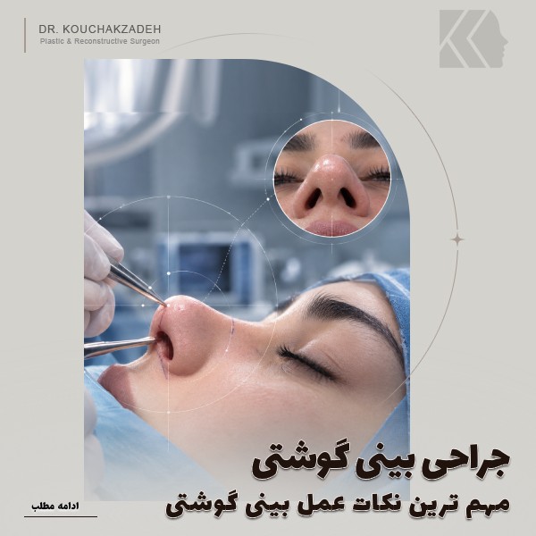 جراحی بینی گوشتی و پهن+مهم ترین نکات عمل