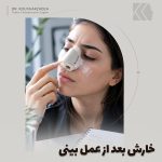 خارش بینی بعد از عمل؛علت و درمان خارش بینی