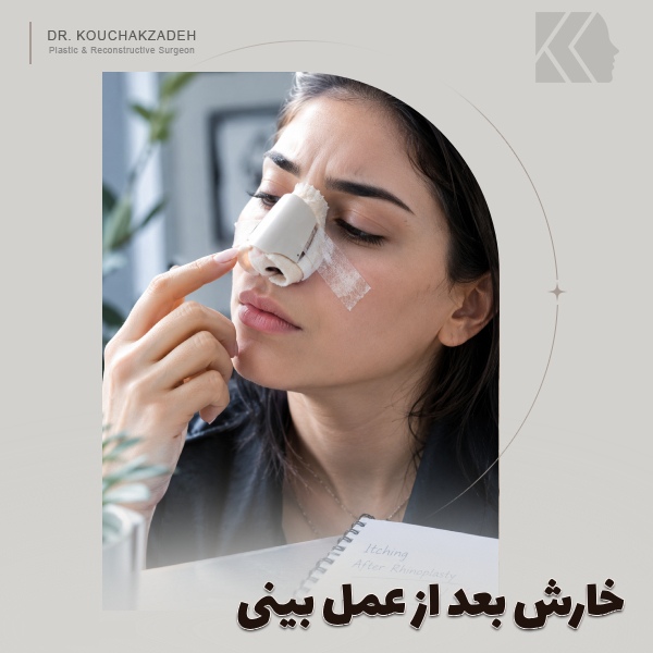 خارش بینی بعد از عمل؛علت و درمان خارش بینی